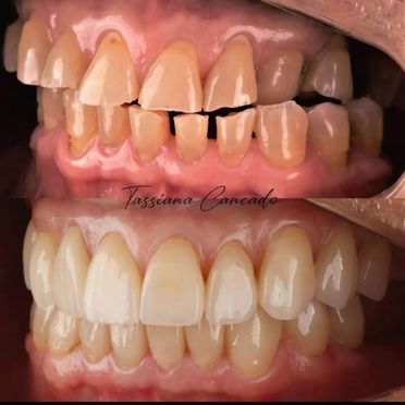 Clínica Dental Rocafort S.L. Rejuvenecimiento dental