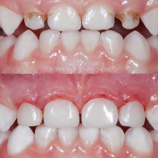 Clínica Dental Rocafort S.L. Odontopediatría