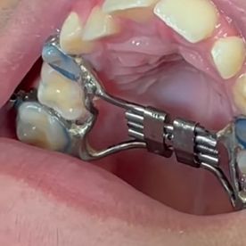 Clínica Dental Rocafort S.L. Ortodoncia