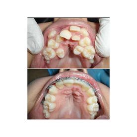 Clínica Dental Rocafort S.L. Ortodoncia