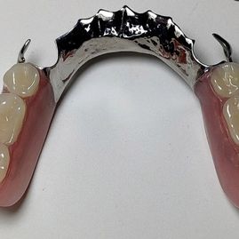 Clínica Dental Rocafort S.L. Prótesis removible